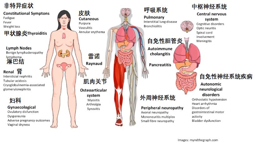 干燥综合症10大表现怎么治疗,干燥综合征是因为环境干燥么
