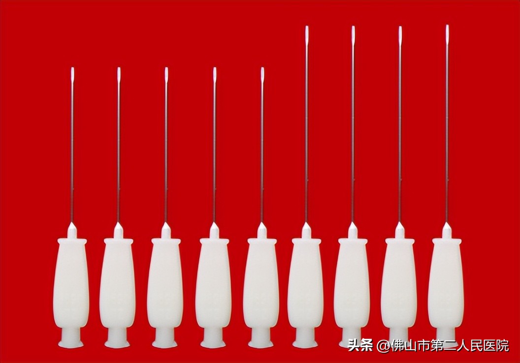 弹响指小针刀治疗演示图,弹响指做针灸能彻底根治吗