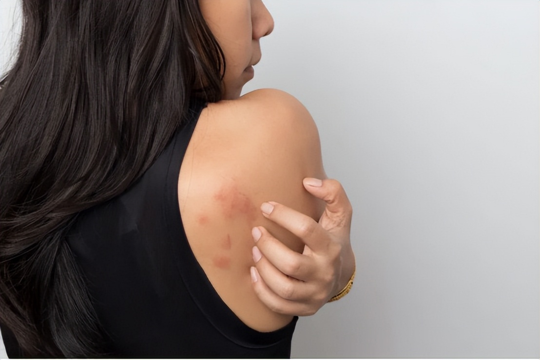 为什么有人一洗澡就过敏,皮肤过敏能用沐浴露或者香皂吗