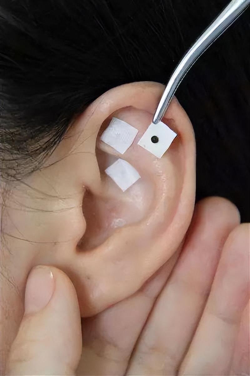 天热湿疹痒痒痒？中医治疗退！退！退！