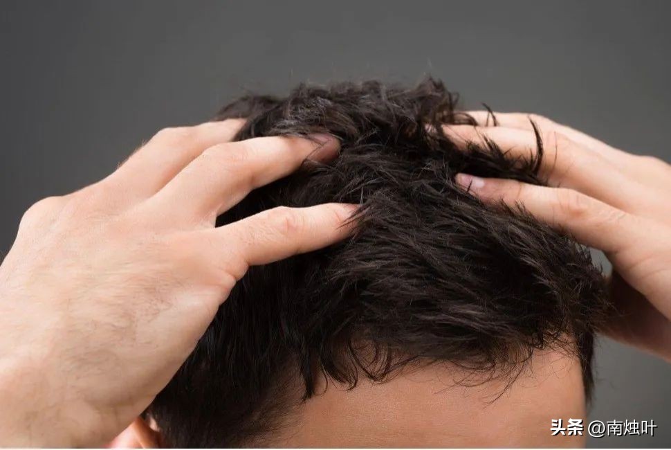 头疗真的不伤头皮吗,做头疗真的能治头皮炎吗