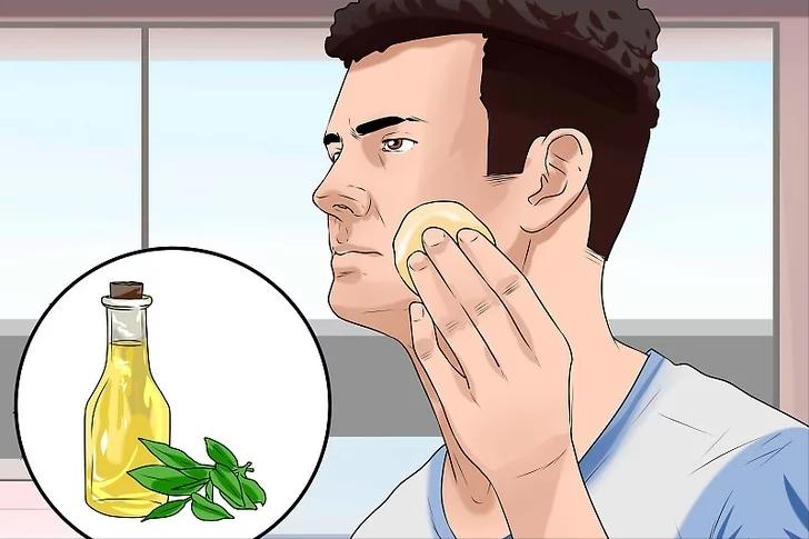 怎样在一夜之间消灭痘痘,如何在一周之内祛除青春痘0成本