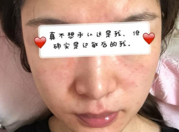 十大公认好用的孕妇水乳,孕期水乳推荐明星