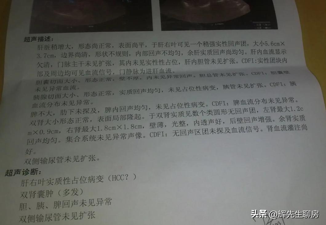 刚买了新房后确诊癌症，剩下的房贷、装修贷怎么办