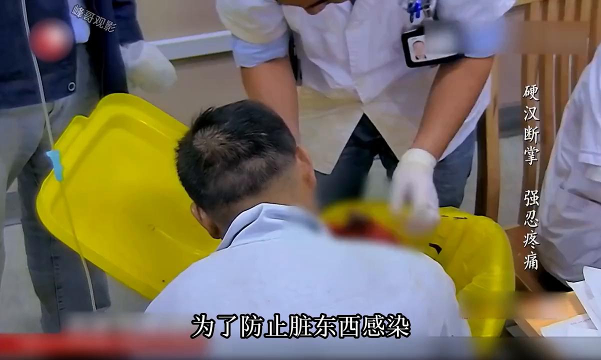 29岁男人的手被千斤顶砸了,29岁的男人被千斤顶手掌原视频