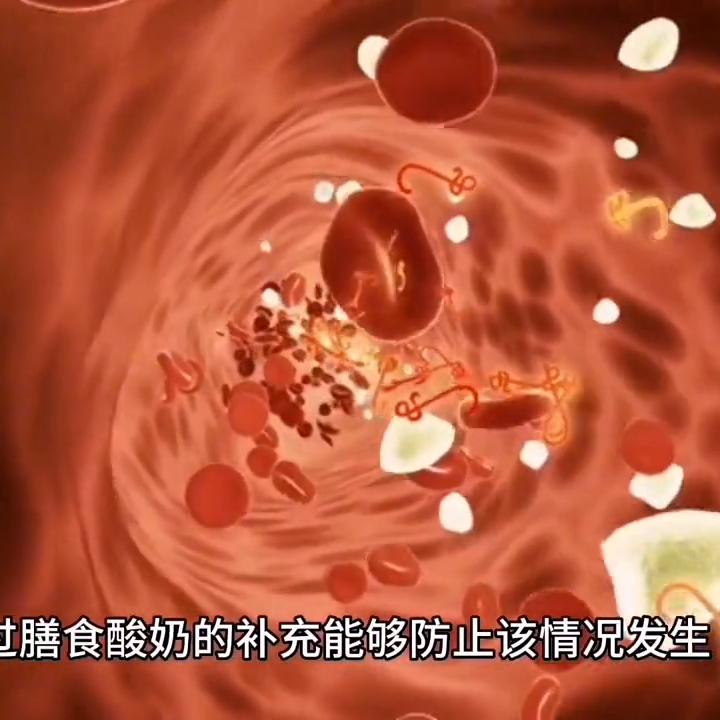 酸奶减脂期能喝哪些酸奶,减脂期喝无糖酸奶跟有糖酸奶