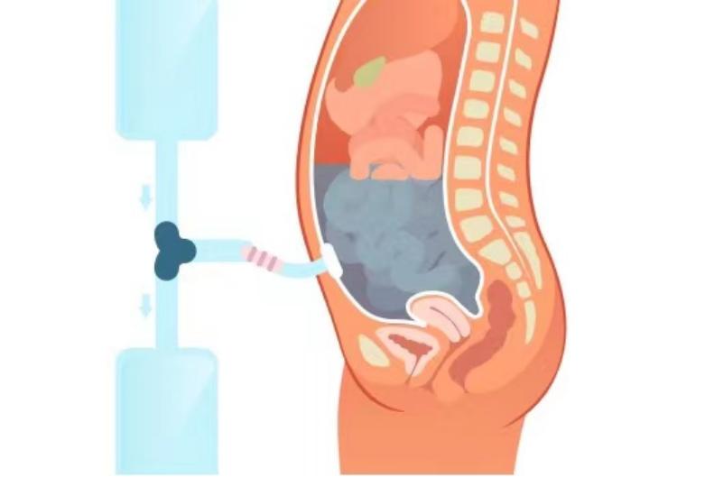 第1健康丨居家可做，助力肾友重返社会