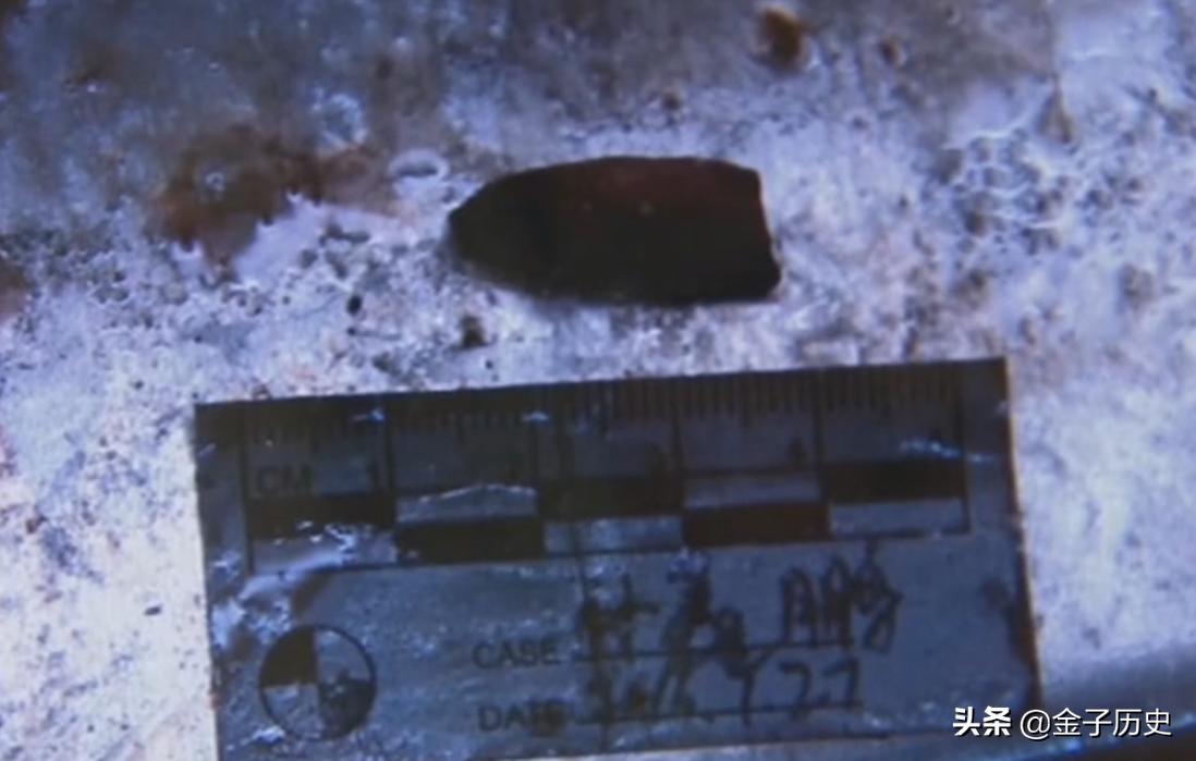 3岁男孩补牙途中意外身亡,3岁男孩补牙死亡