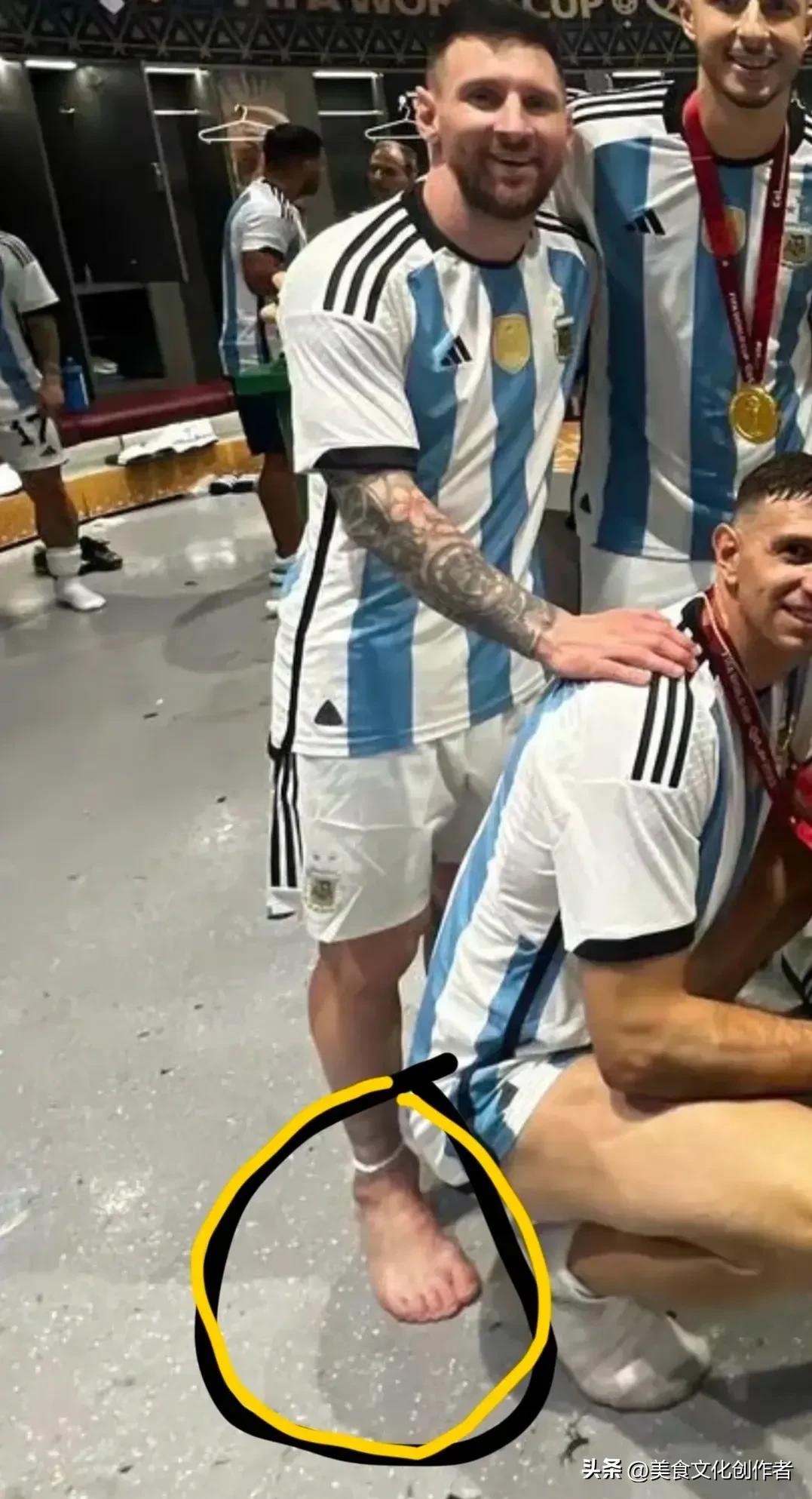 世界杯冠军鞋,世界杯c罗脚