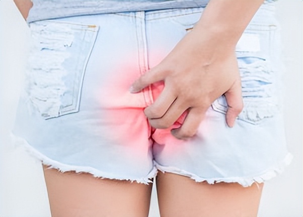 肛门和外阴瘙痒是什么原因,肛门瘙痒潮湿原因