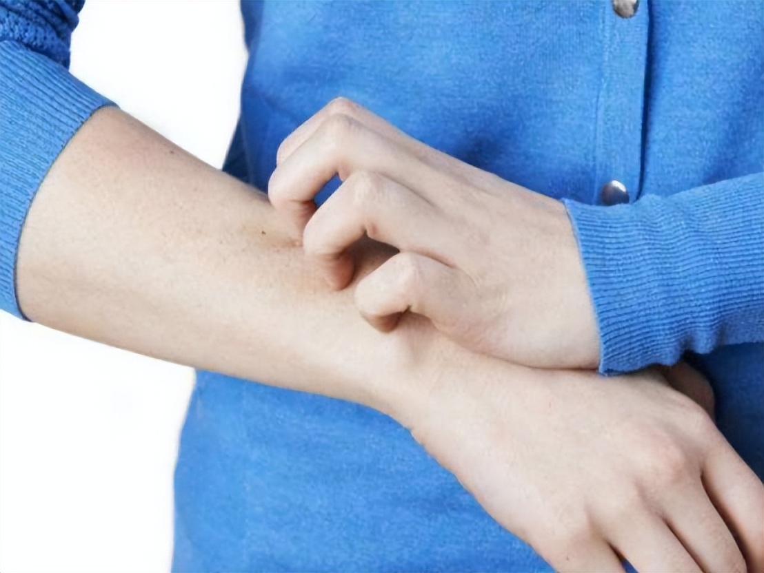 神经性皮炎喝过中药后为啥更痒,手越抓越痒是皮炎还是真菌感染