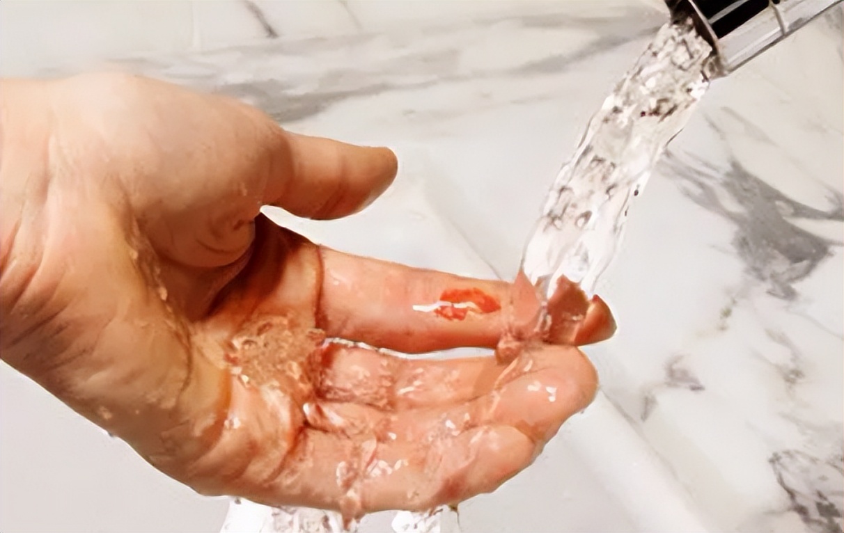 脚上破了很大一块皮怎么消炎,脚上破了很大一块皮怎么办