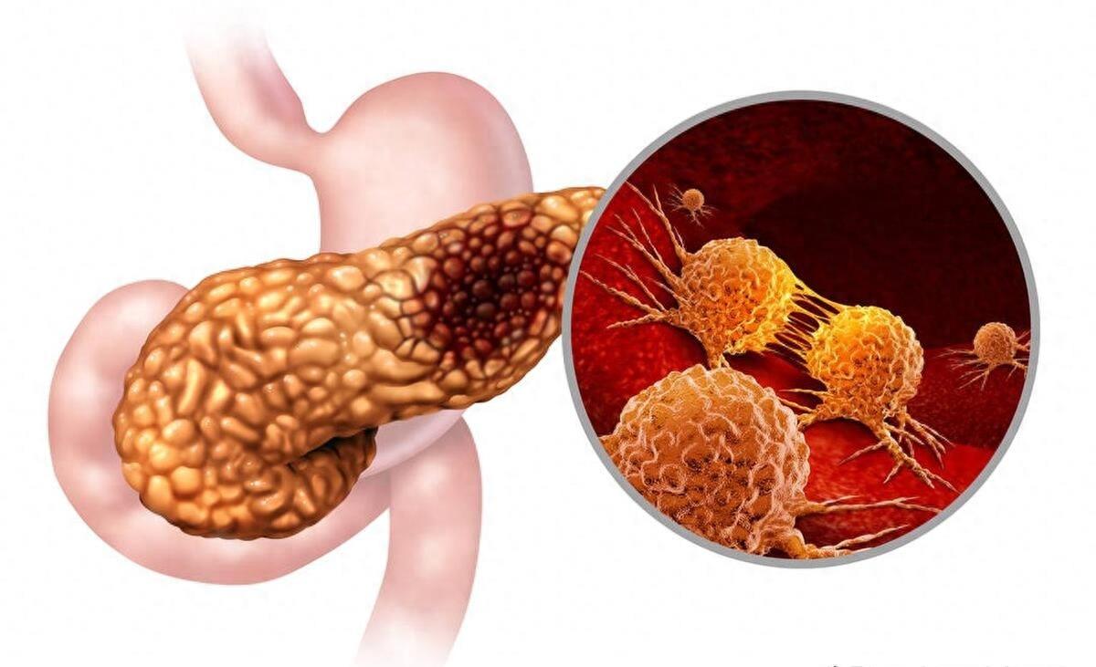 乔布斯抗癌8年状态,乔布斯抗癌8年花多少钱
