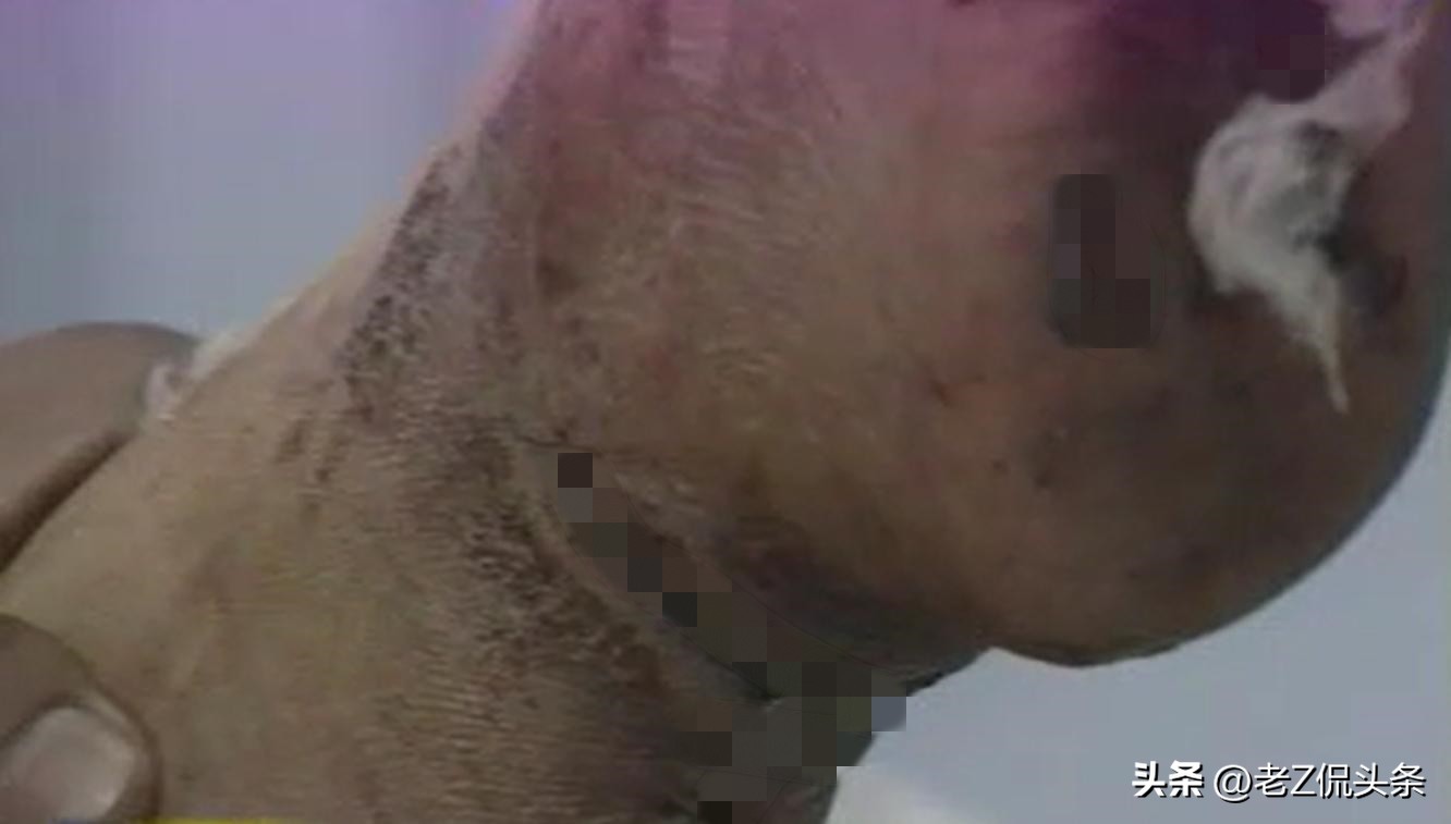 【以案析理】残暴丈夫割开妻子脚踝挑断脚筋，却说没弄死就不犯法