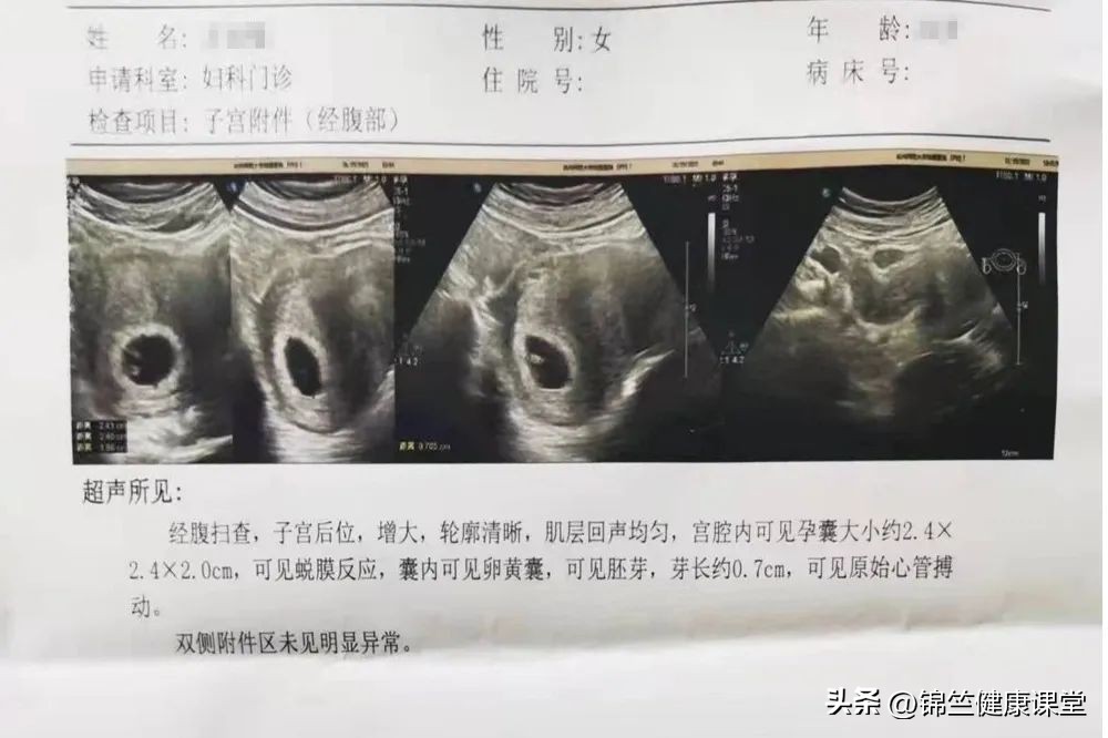 瑞金医院生小孩,上海嘉定瑞金医院产检建卡流程