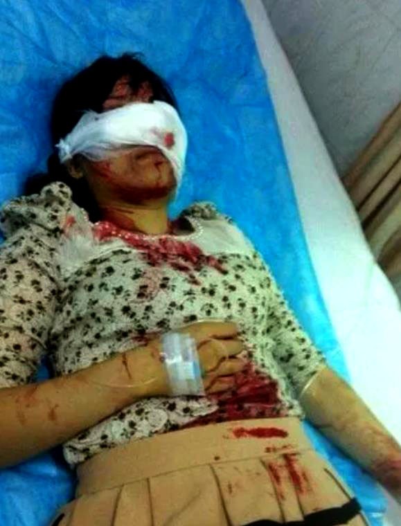 女子在诊所被人砍杀系情杀,女子刺伤牙医事件通报