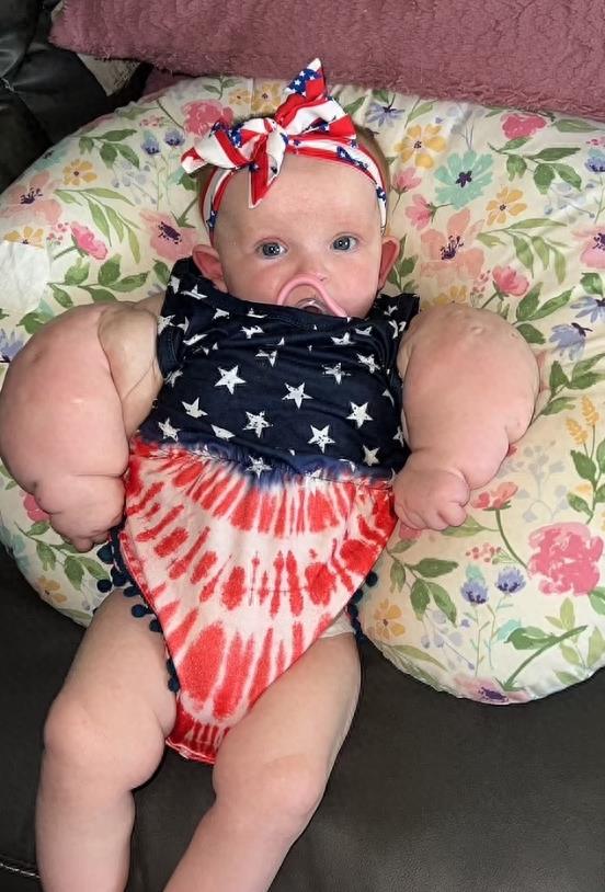 美国婴儿女孩,美国女婴身体患绝症