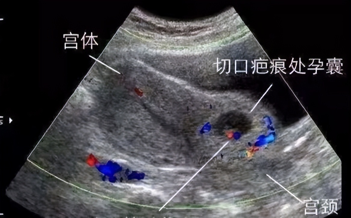 陕西中医药大学第二附属医院急诊,陕西中医药大学第二附属医院急救