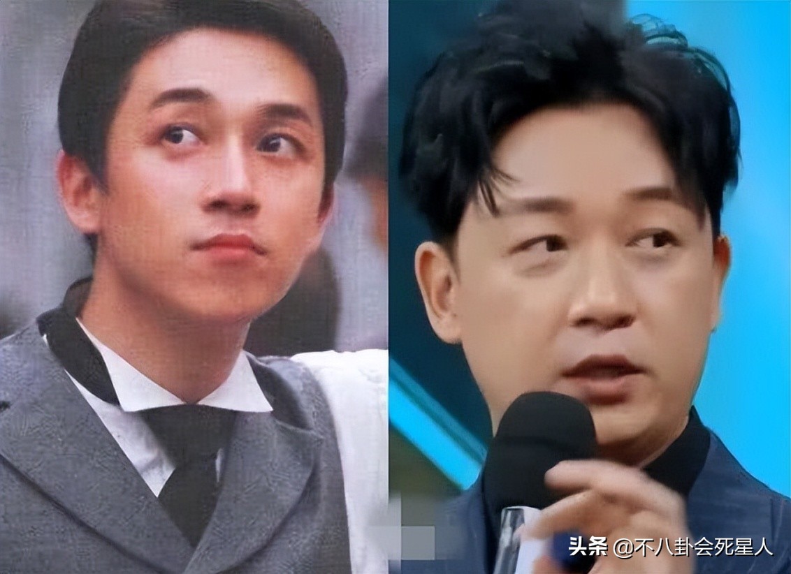 脸部垮掉的男人,脸部塌陷的男生