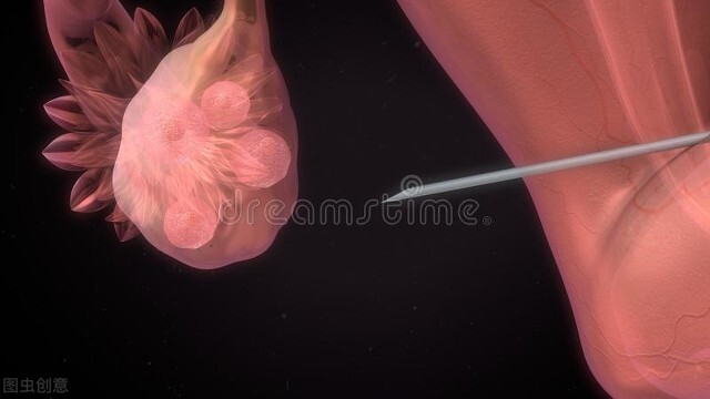 做试管婴儿只能做一次吗,试管婴儿促排取几个卵合适