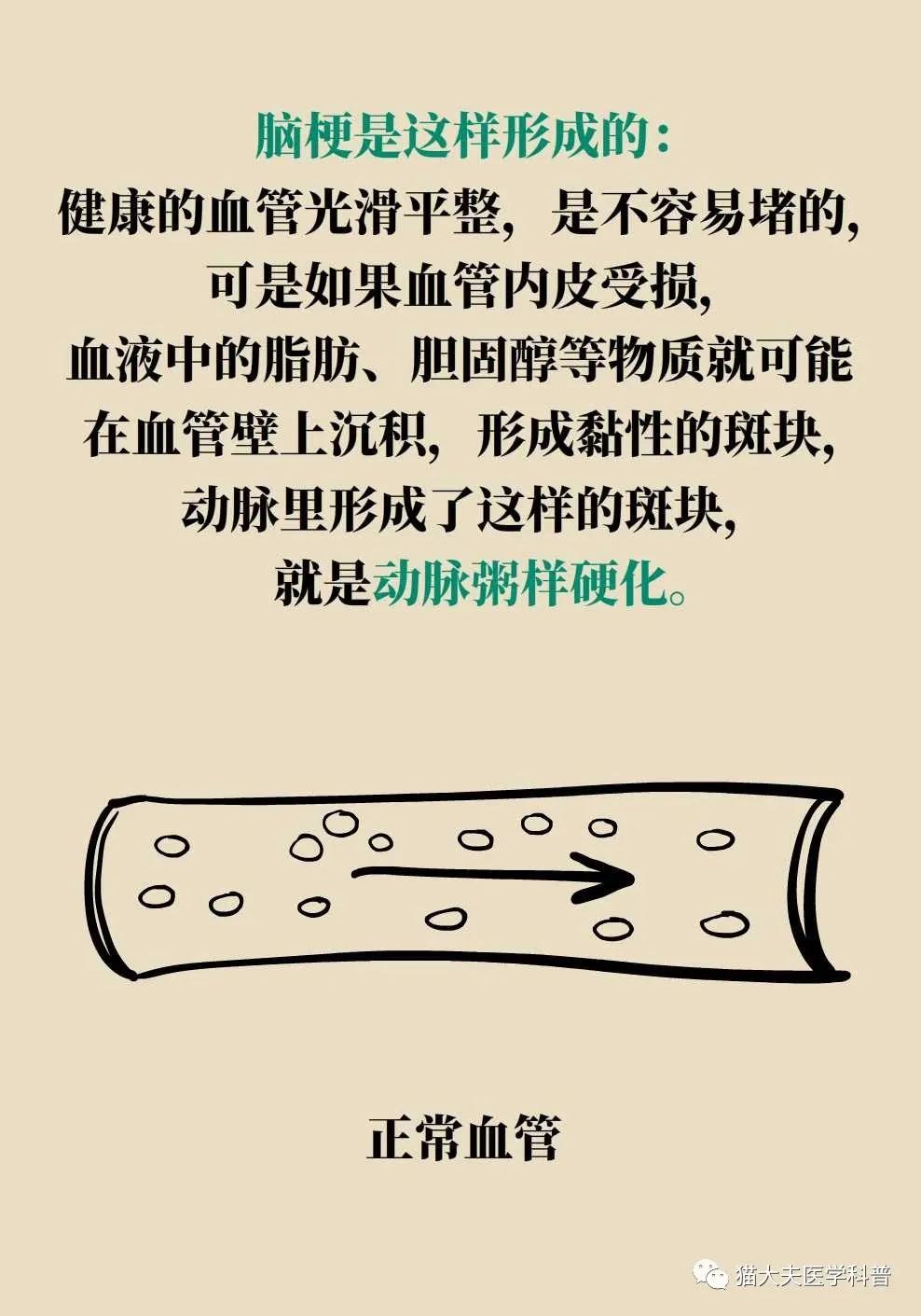 血管健康日为什么定在5月18日,血管的健康日