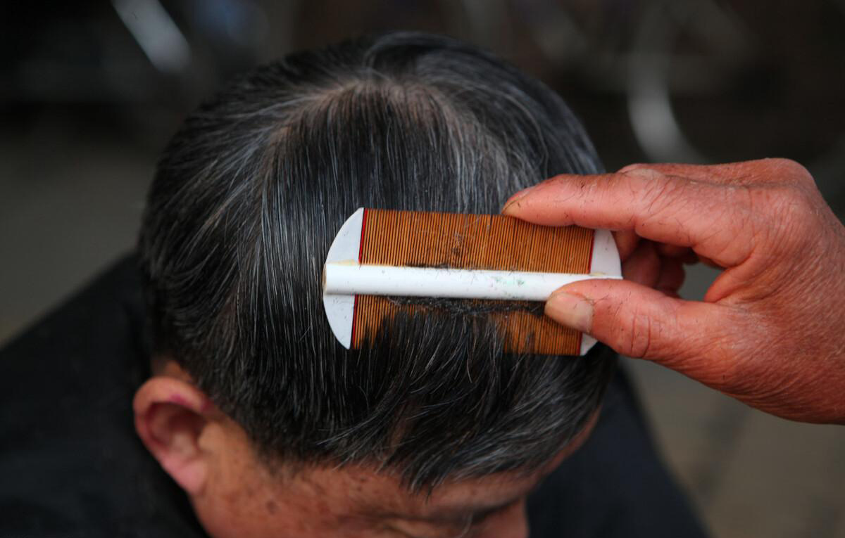 虱子在头上有什么危害,虱子对人体有哪些害处