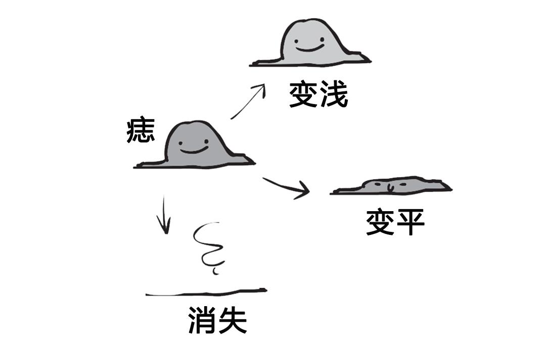 如何判断新长的痣是不是黑色素瘤,正常痣和黑色素痣图片对比说明