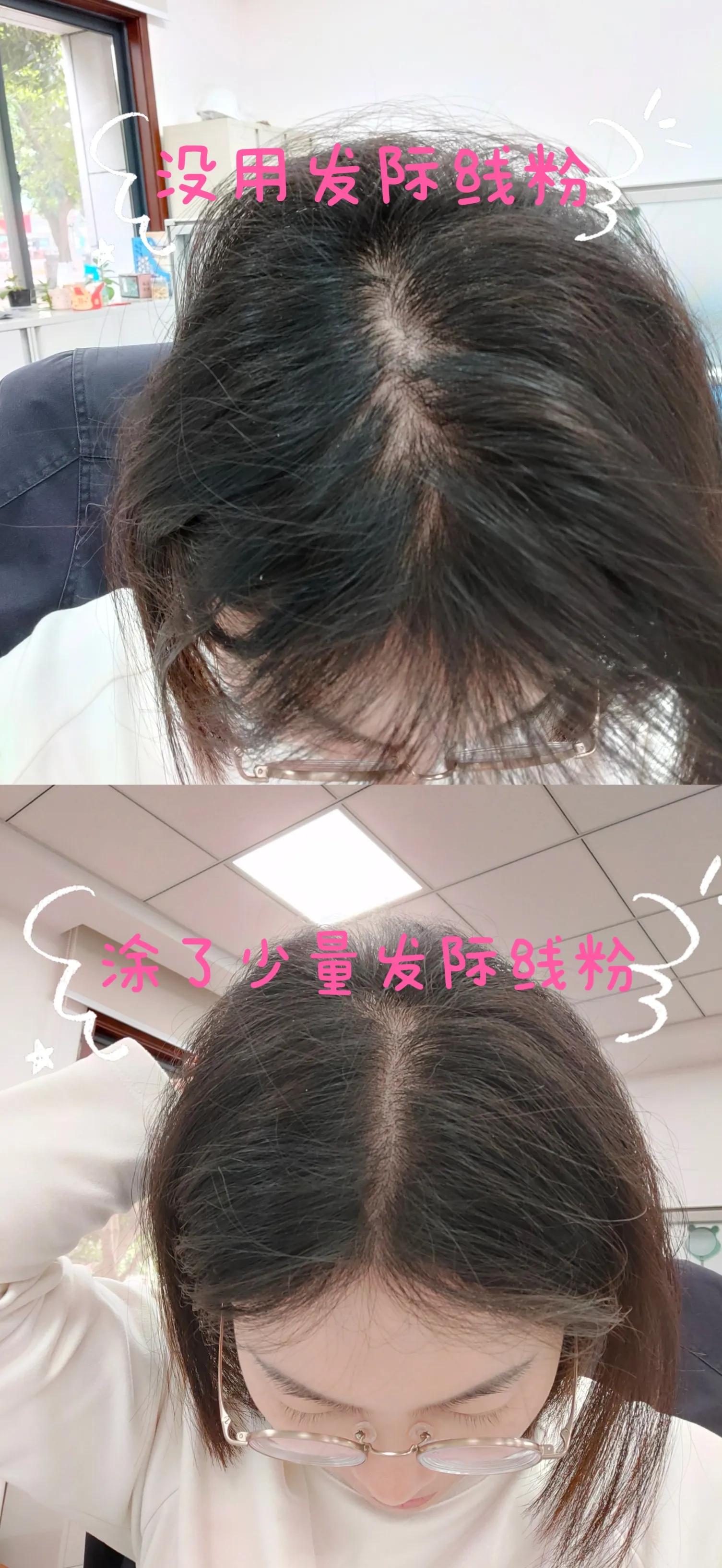 脱发的人士看过来,脱发熬夜的小伙伴看过来