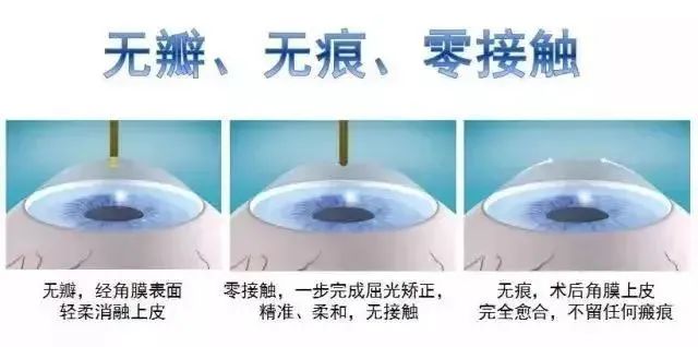 南开征兵体检矫正视力,征兵体检眼科沙眼