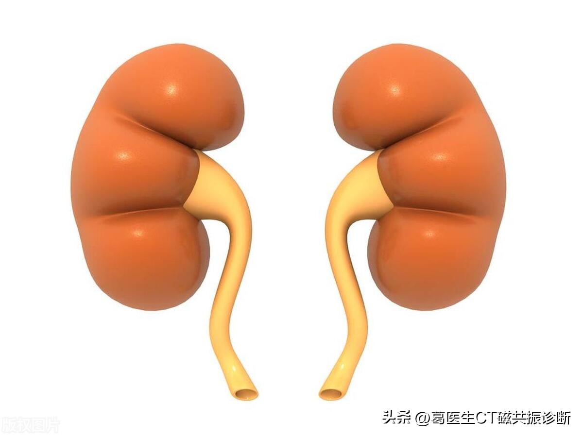 增强ct能鉴别肾囊肿与肾错构瘤吗,肾错构瘤和肾囊肿的b超