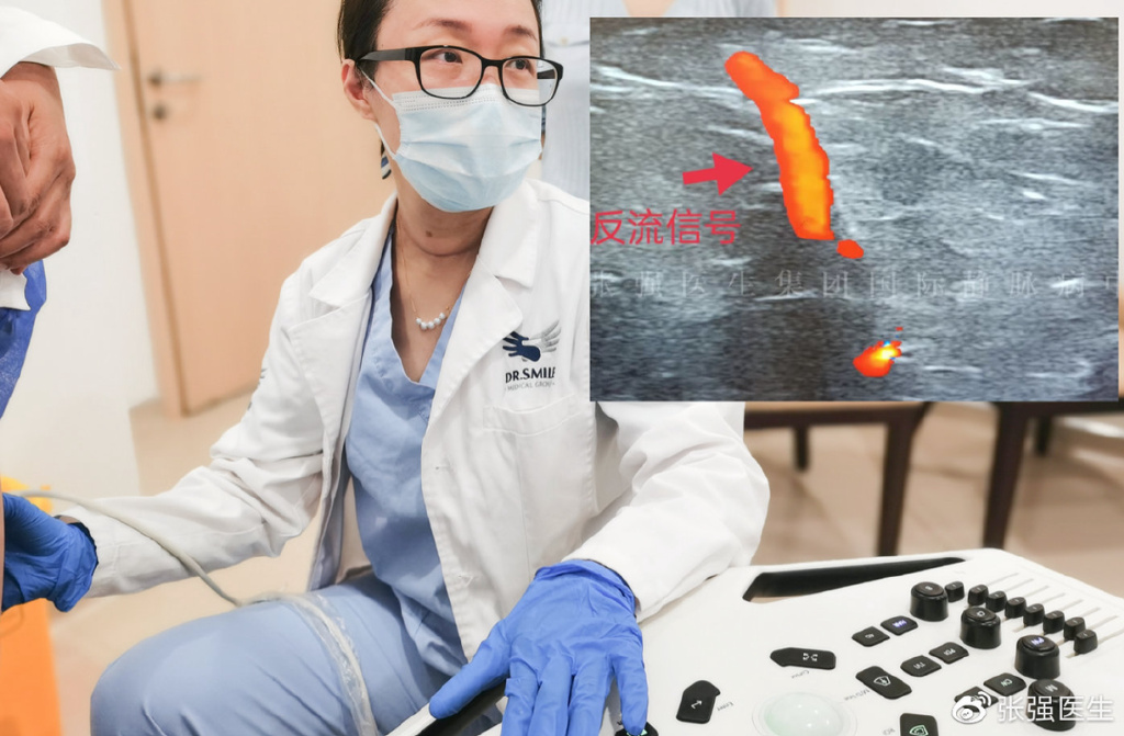 静脉曲张可以根治吗,静脉曲张能治好吗