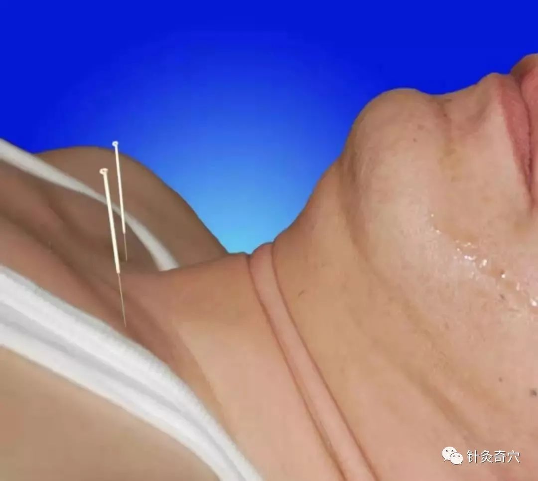 史上最全中医针灸视频教程全集,针灸治疗真实图片大全