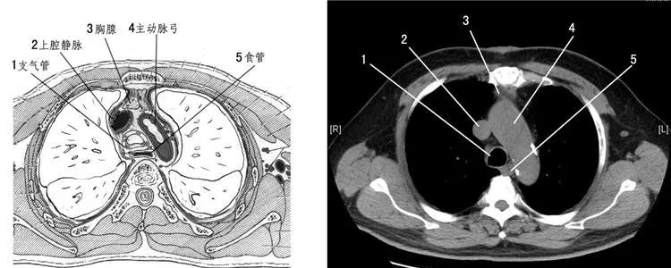 患者男59岁反复胸闷,患者男性59岁因心悸持续一小时