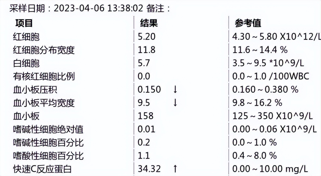 ai系统工作效率,iphone手机ai智能工具提升工作效率