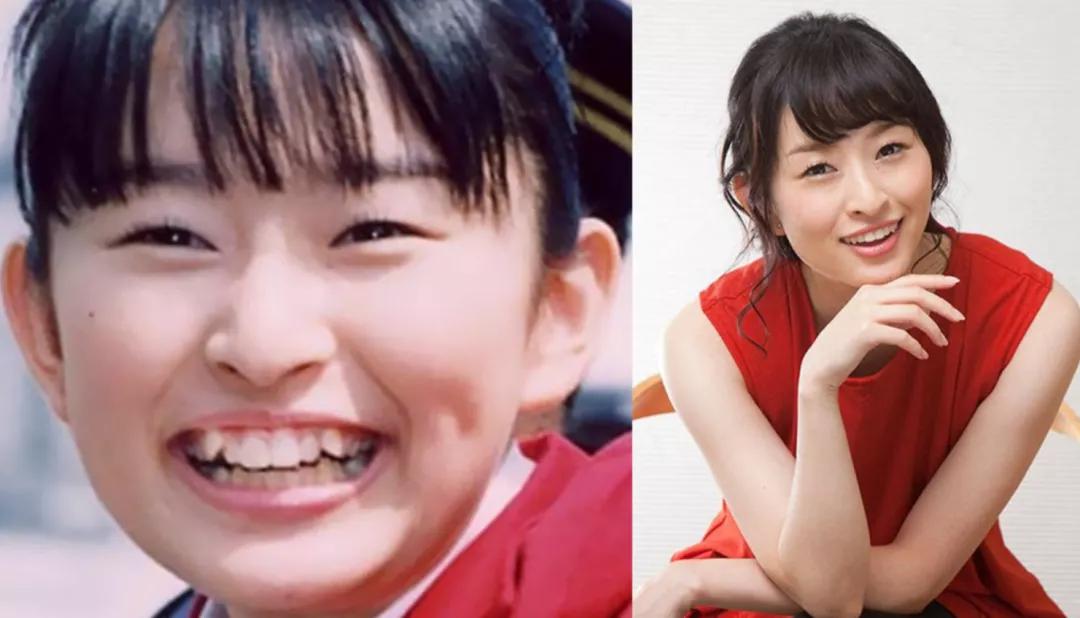 日本整牙的明星,日本整牙明星