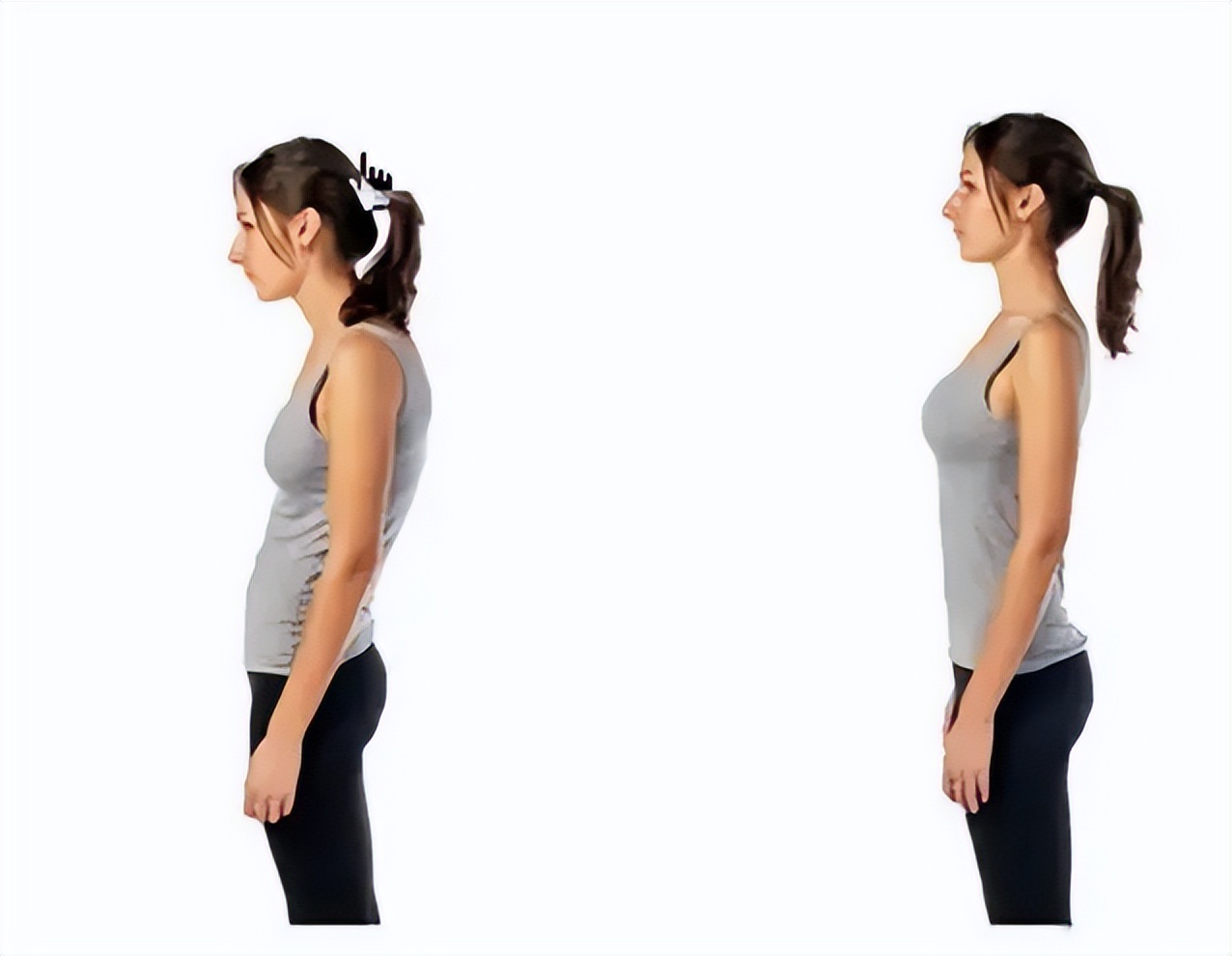 背微驼怎么矫正,孩子背有点驼怎么矫正