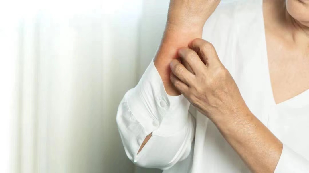 湿疹可以治好吗湿疹是怎么引起的,湿疹是怎样引起的如何治疗