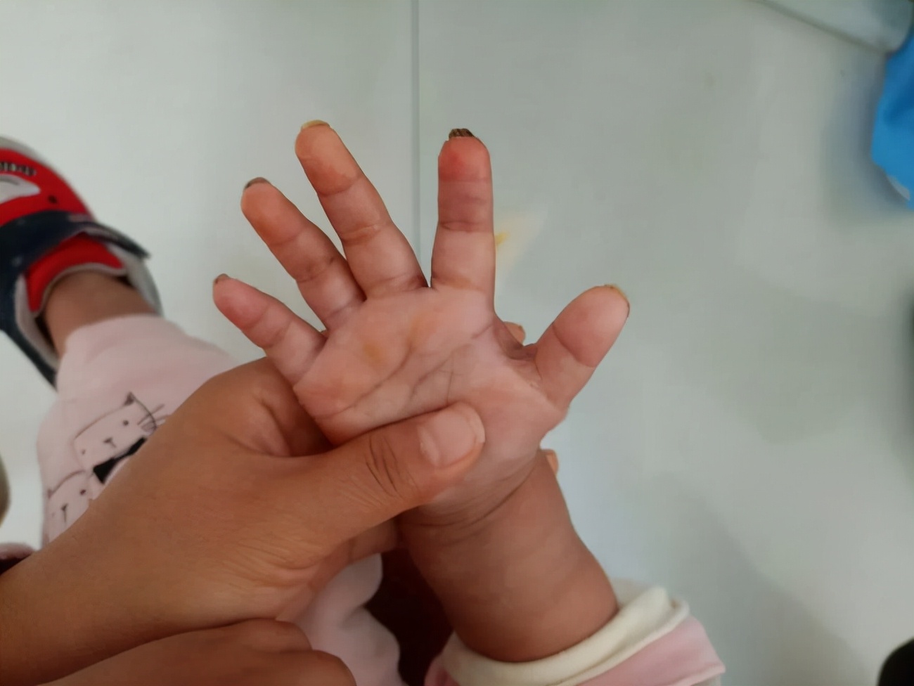 兔子为什么咬小孩的手指,兔子咬断11个月大小孩手指