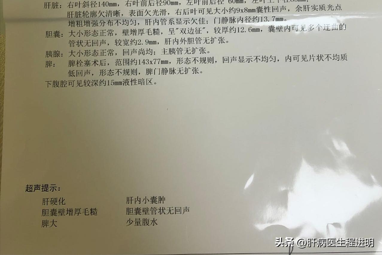 乙肝被彻底改变,乙肝规范治疗能活多少年