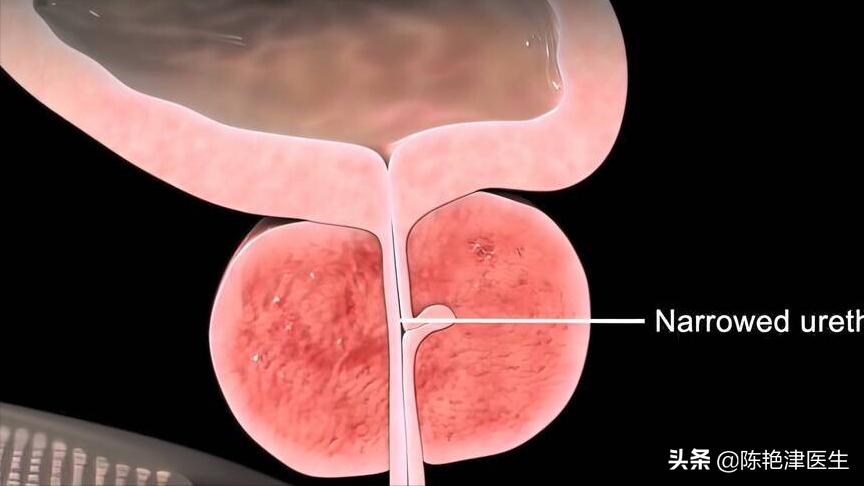 哪些检查项目没必要做,医生提醒这5件事要少做