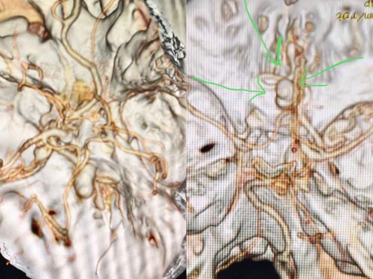 一个值得唠叨几句的病例