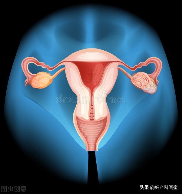 此路通不通，您痛不痛！子宫输卵管造影，最关心、担心的都在这
