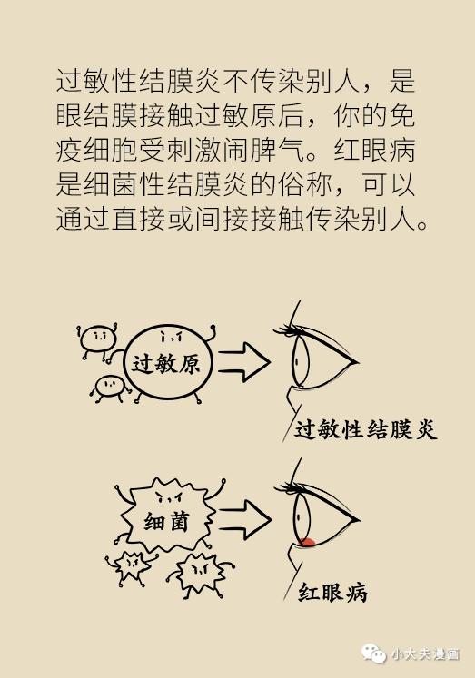 眼睛红痒是什么原因用什么眼药水,眼睛干痒是怎么回事用什么眼药水