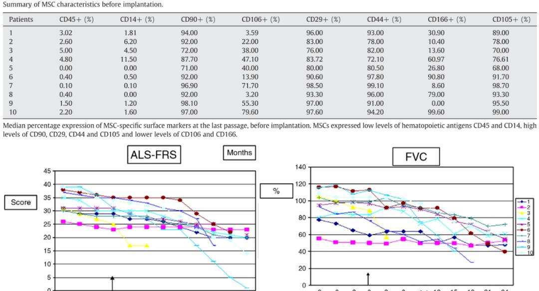 渐冻症干细胞治愈案例,渐冻症特效药生命之光