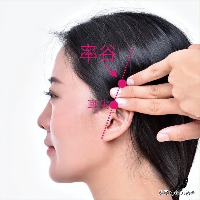 阳康之后头痛怎么办,阳康之后一直头疼是怎么回事