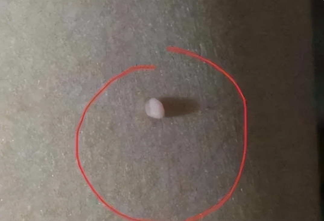 脖子腋下的小肉粒是什么,脖子腋下长小肉粒可以用手揪掉吗