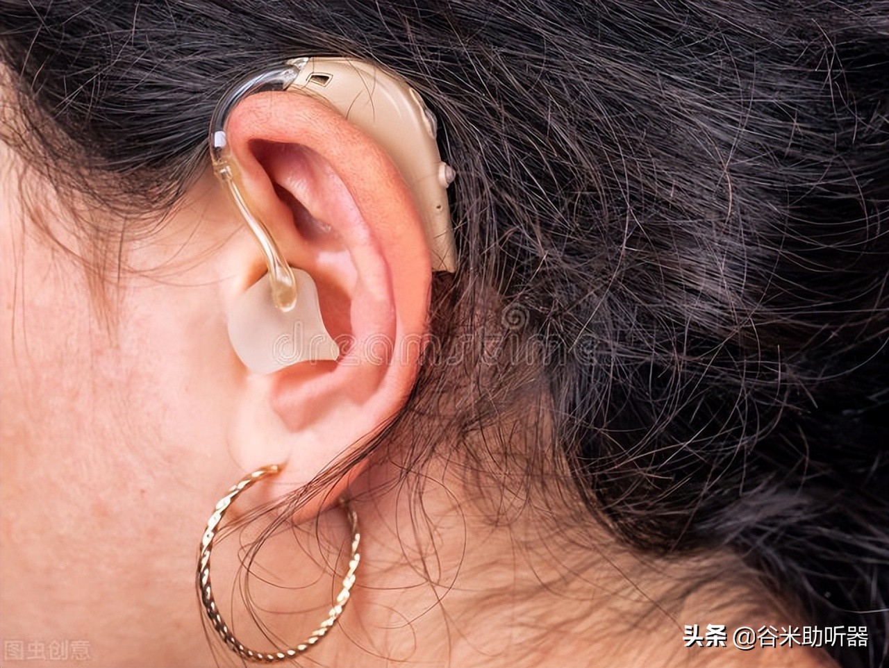 戴上助听器耳屎都在里面怎么办,戴助听器耳朵会闷怎么办