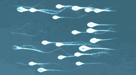 体检查出“少弱精症”，怎么办？义诊来啦~