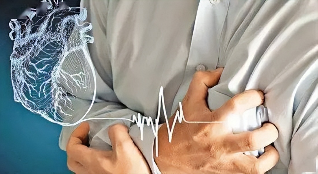 天津oct冠脉介入治疗,oct检查为冠心病诊治带来的启示