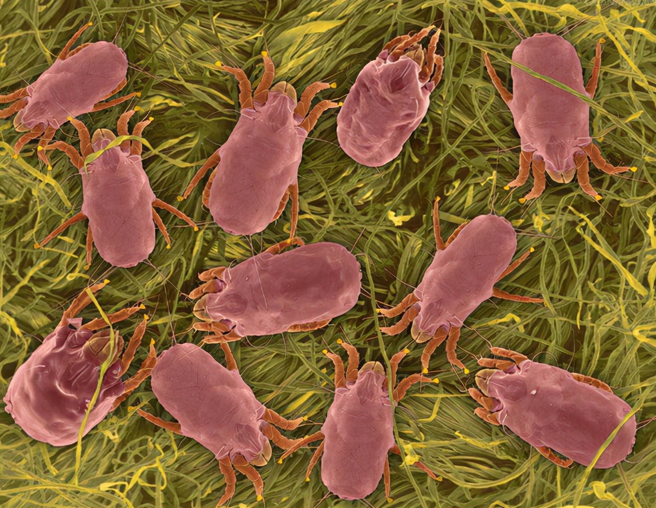 鼻子上挤出来的白色条是什么,鼻子里有白色条状粘稠物